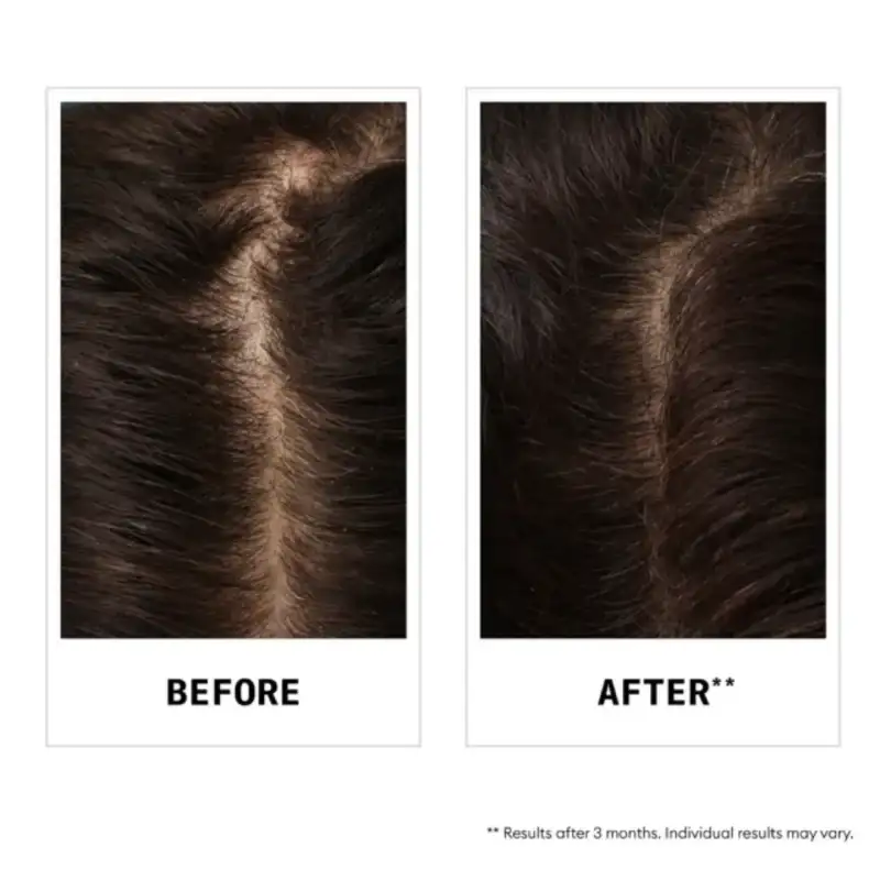 Product gallery image 4